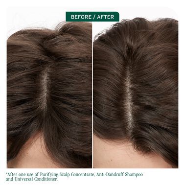 Scalp Sync Purifying Scalp Concentrate - Biolage Renovation NZ | L'Oréal Partner Shop